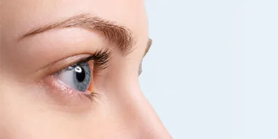 lower eyelid surgery, eyebag removal
