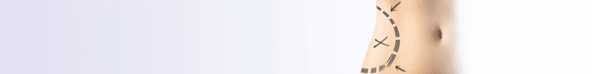 laser liposuction treatments